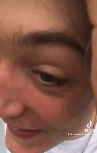 @🙈