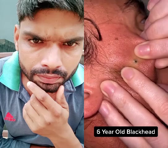@Rahul Puri