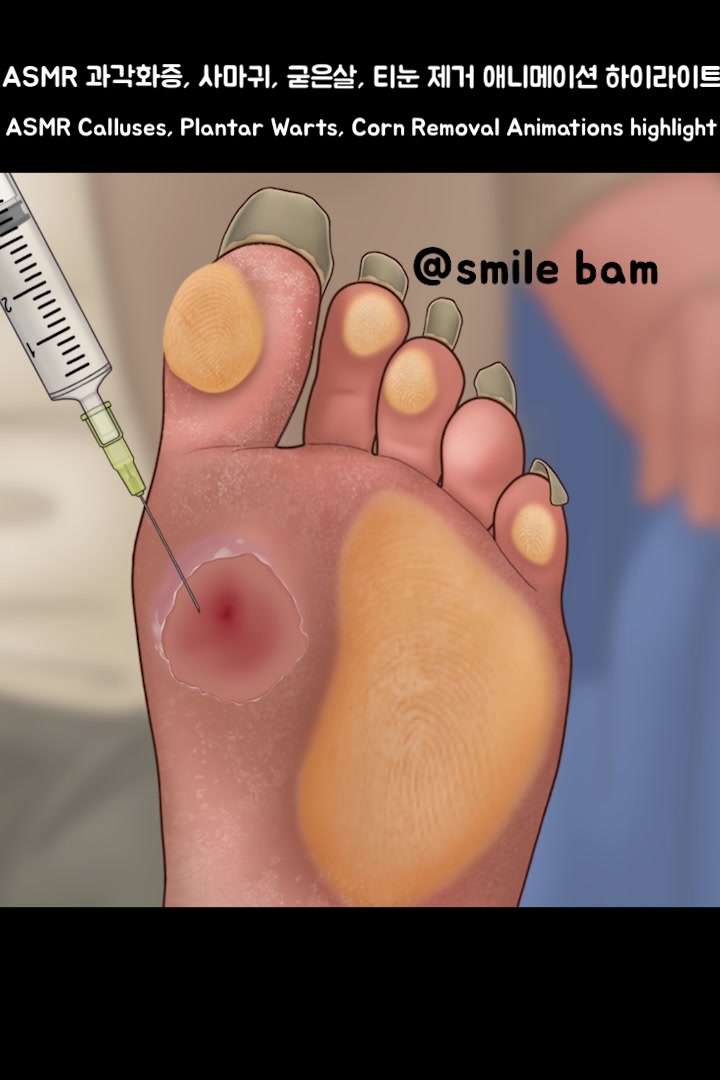 @Smile Bam