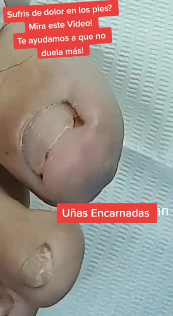 @Podólogia Nordelta