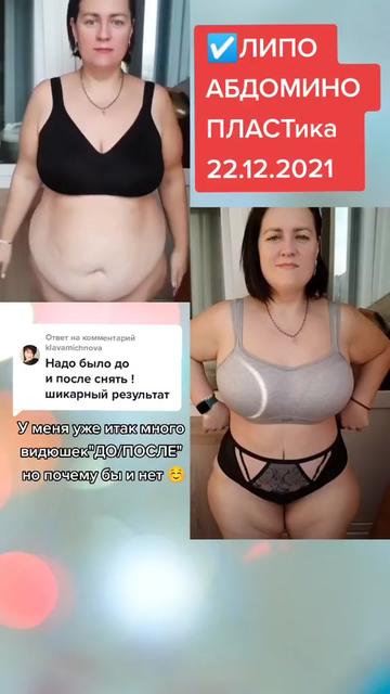 @ТГК : BARIATRIC_LIVE