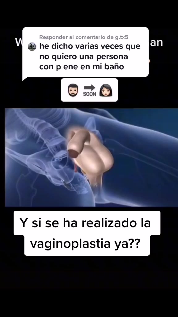 @Andrea Trans