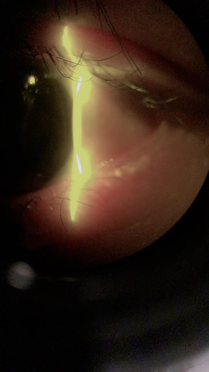 @Hiro|Orthoptist