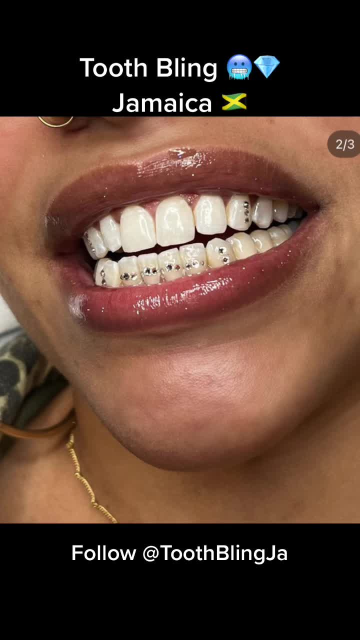 @ToothBlingJa