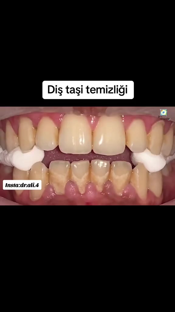 @⚜️ ALİ ⚜️