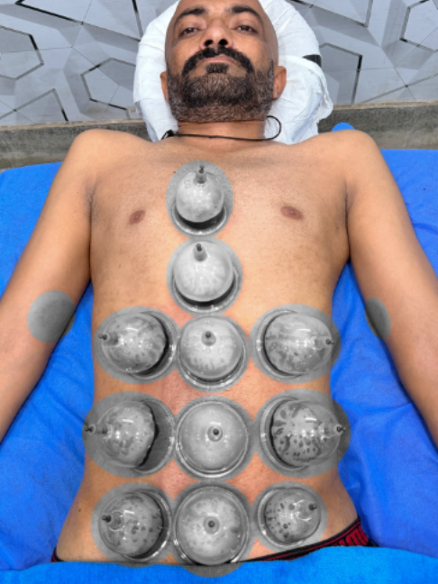 @Doctor & Hijama Cupping Clinic