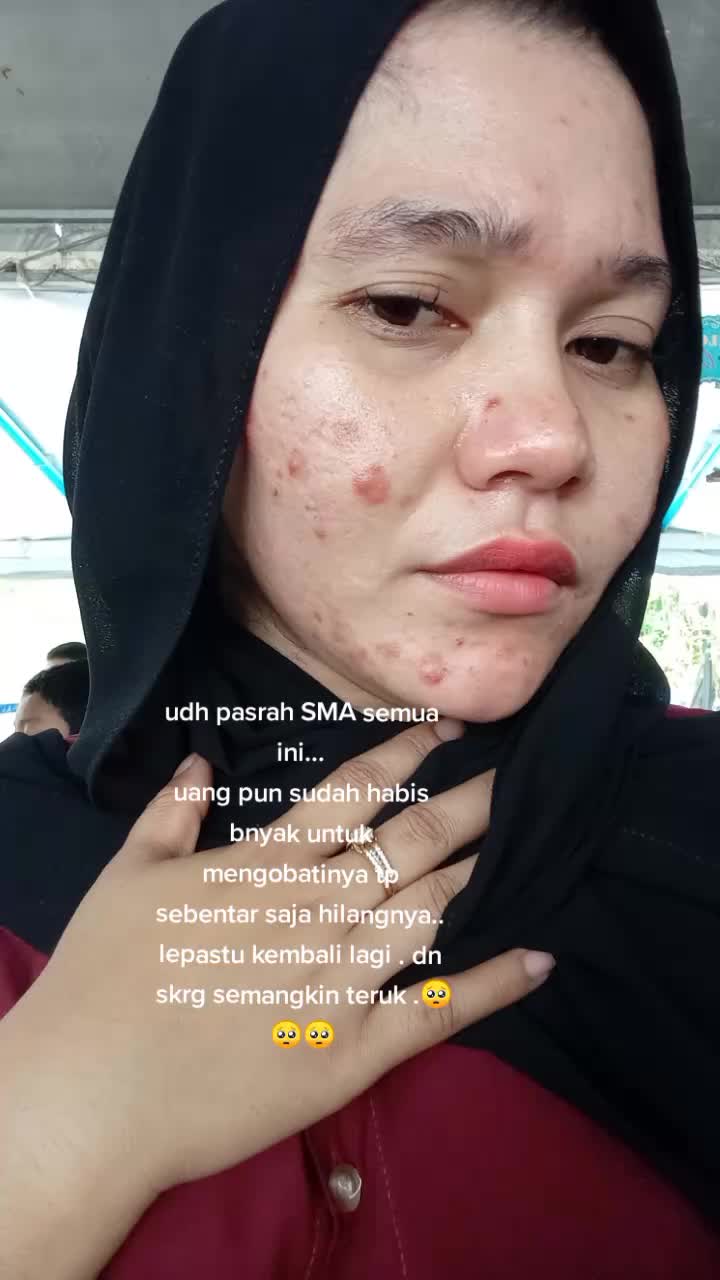 @Sary Sulung