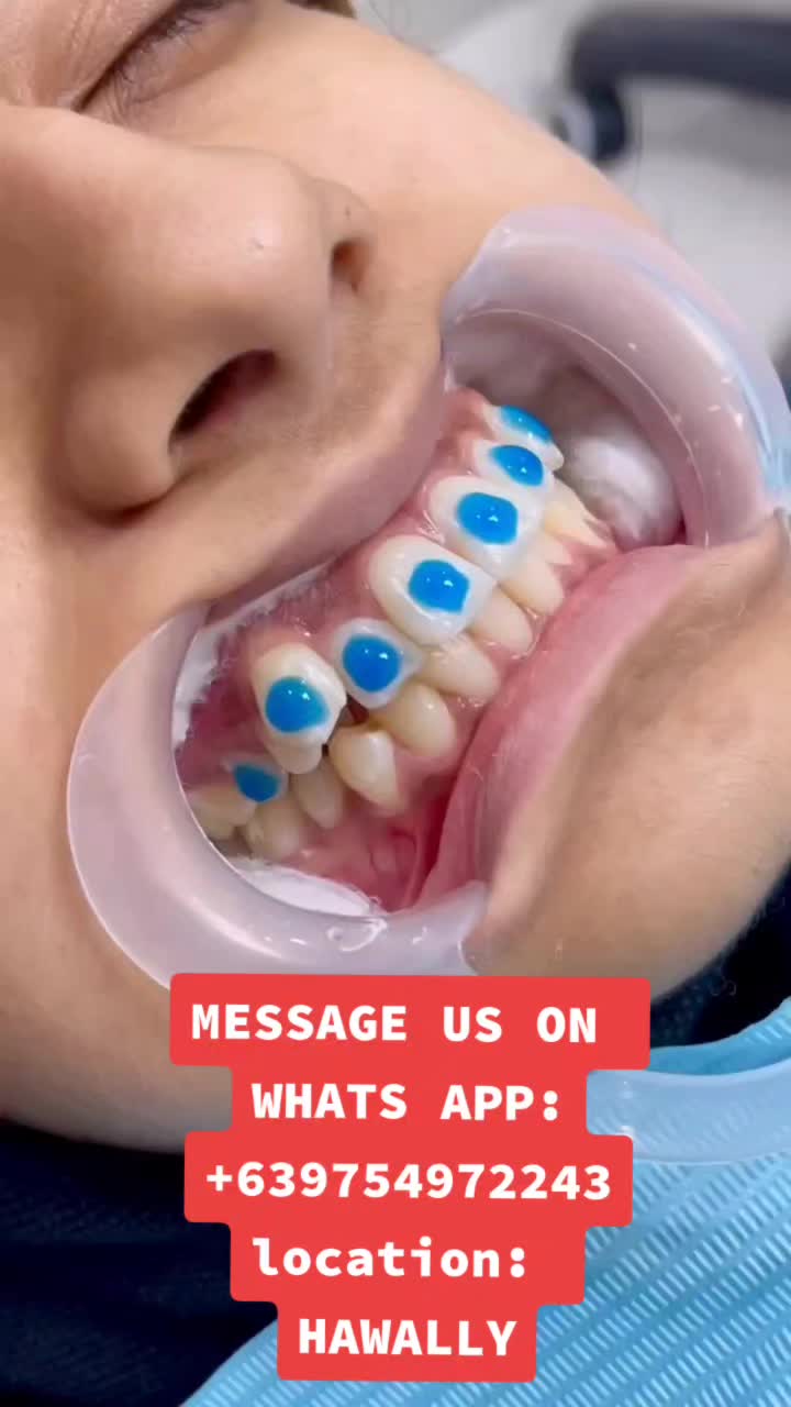 @SmileKabayanKuwait🇰🇼