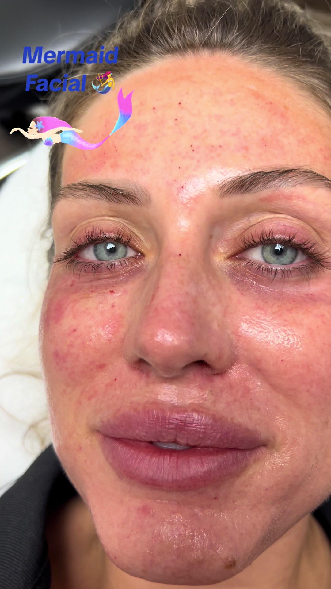 @Beauti4skin MedSpa