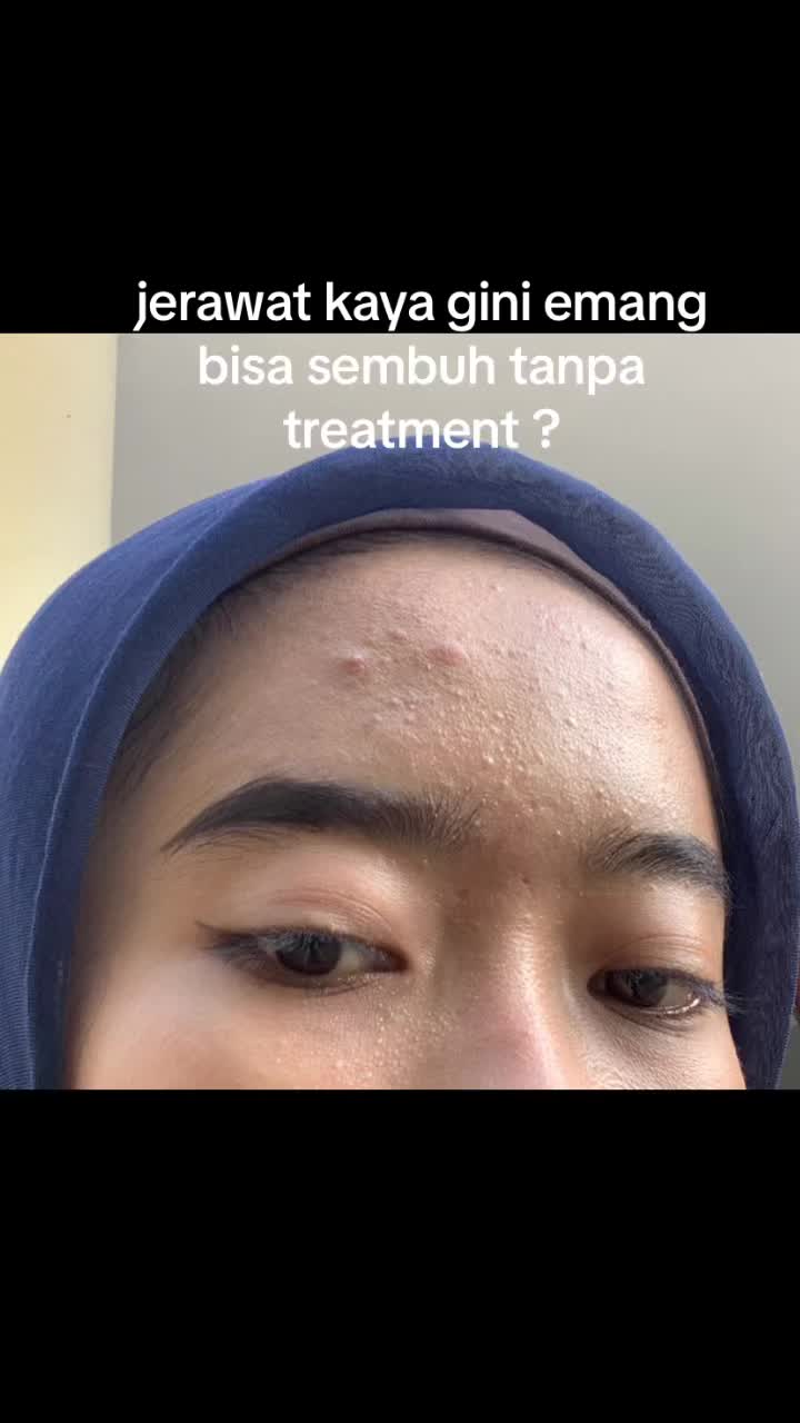 @fiiboy_