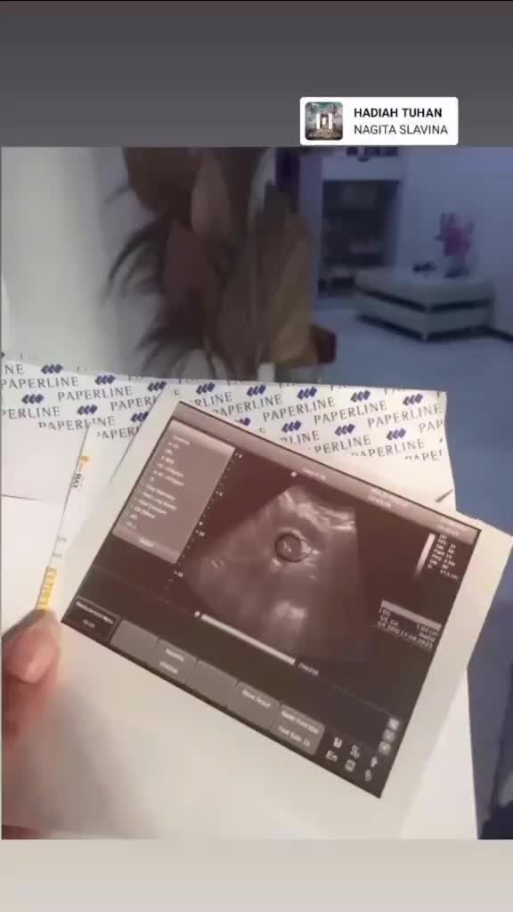 @istiselvya28