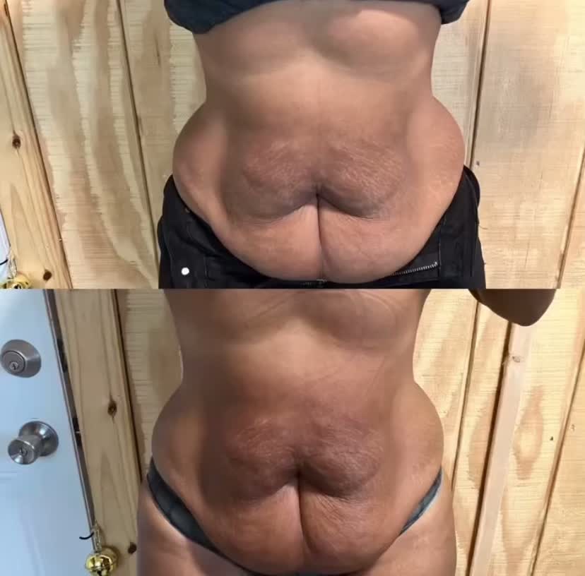 @NeeNee