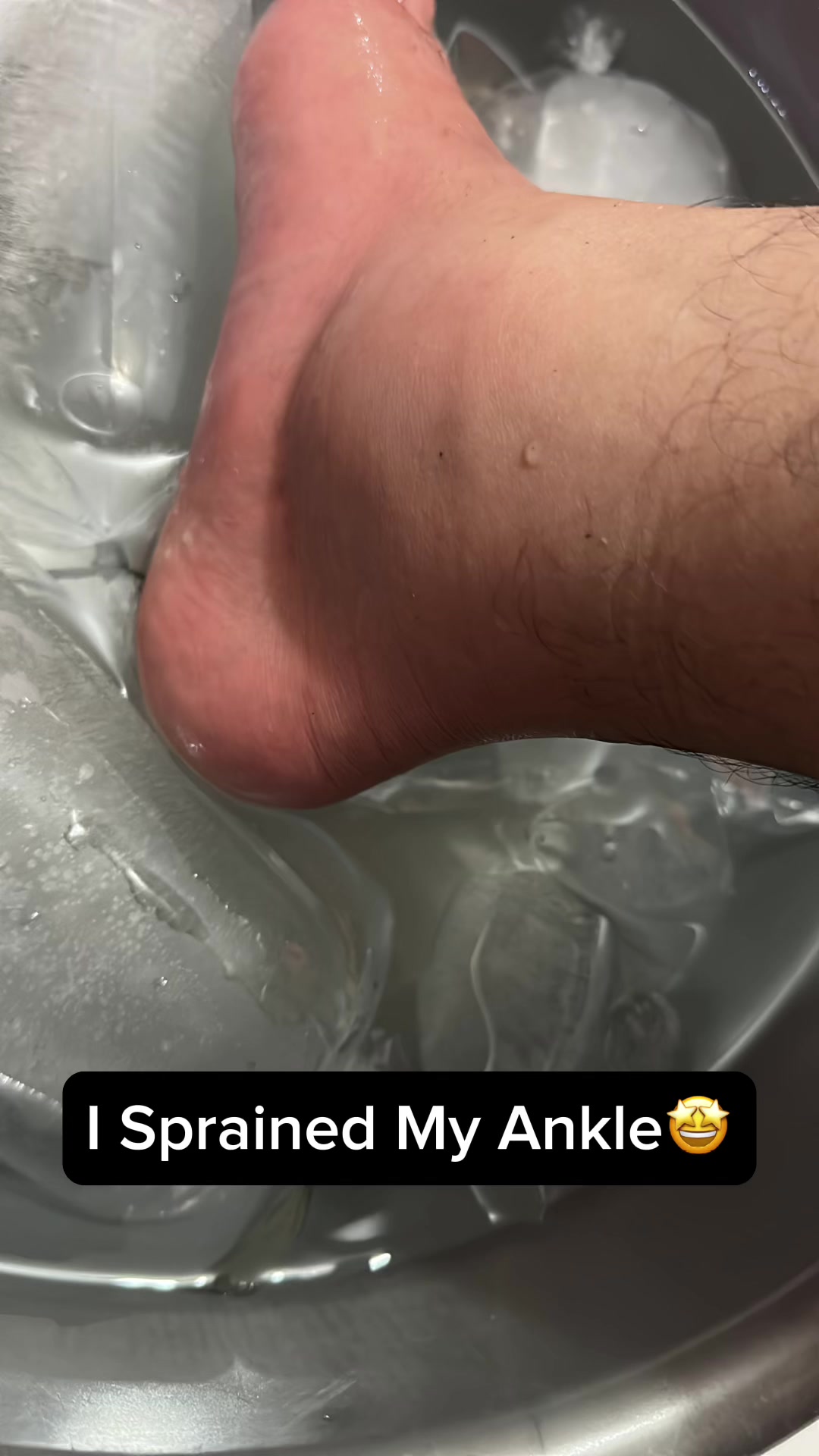@Somasyi