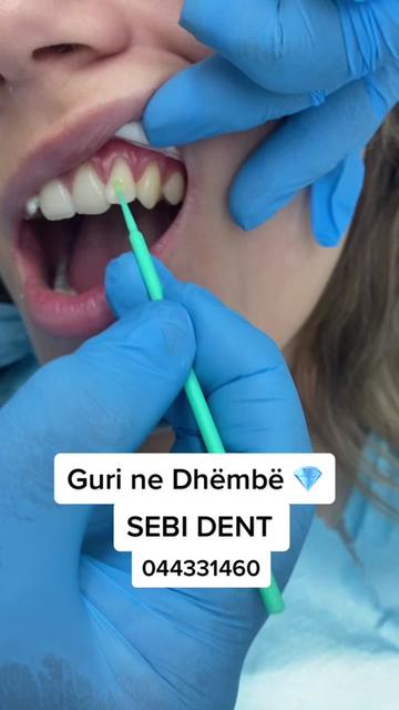 @sebi dent