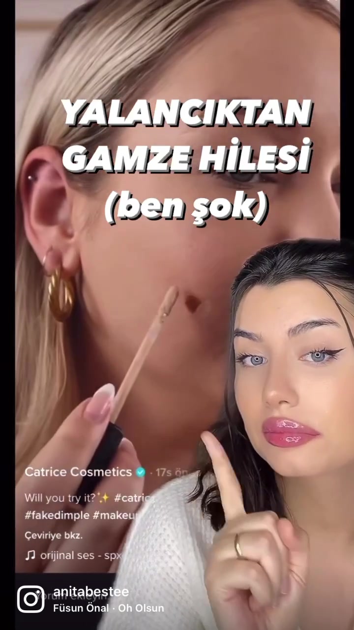@Anita🫶🏼