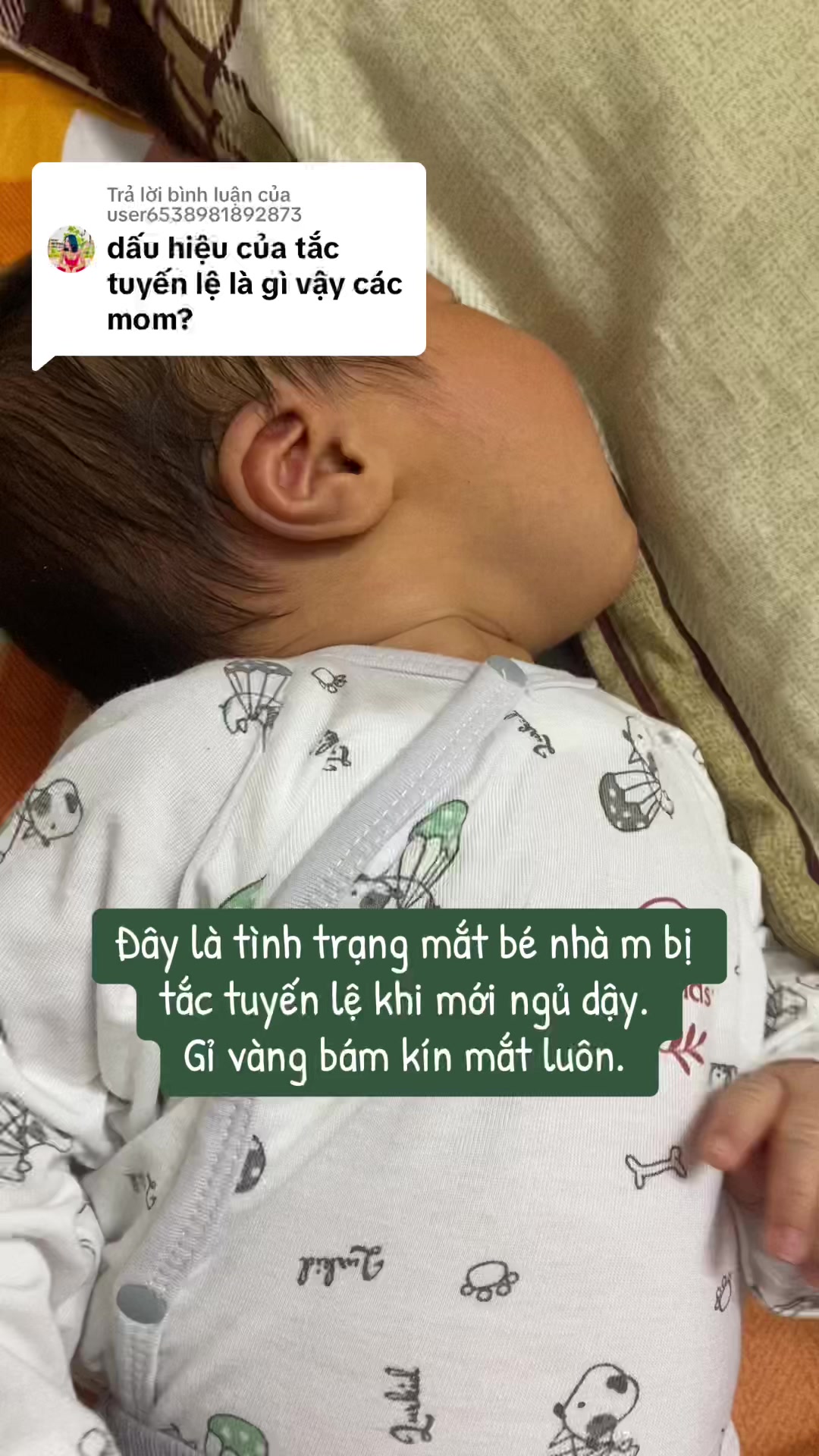 @Huyền P&eacute;oo