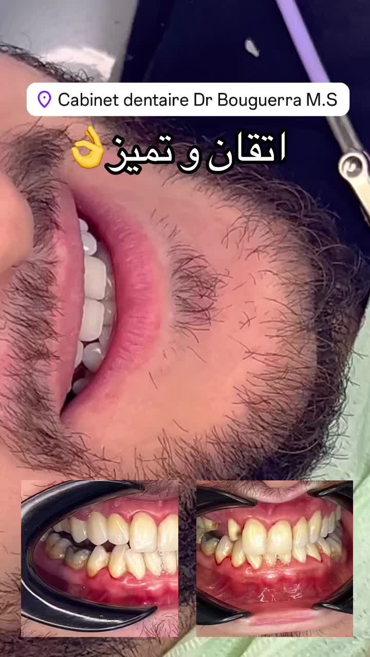@GOSMILE ROUIBA🇩🇿