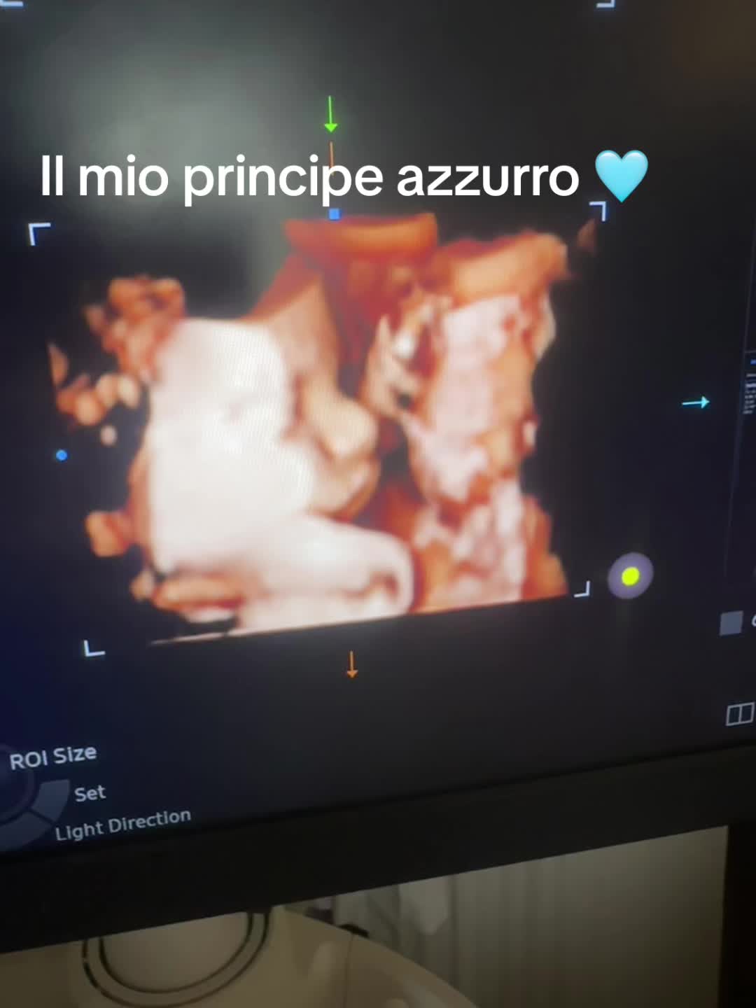@Martina