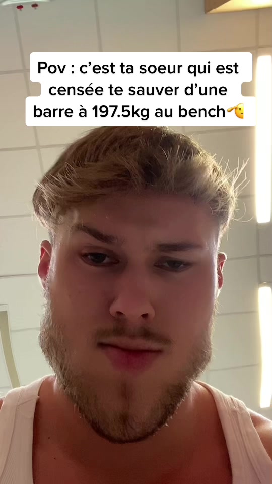 @Albinos