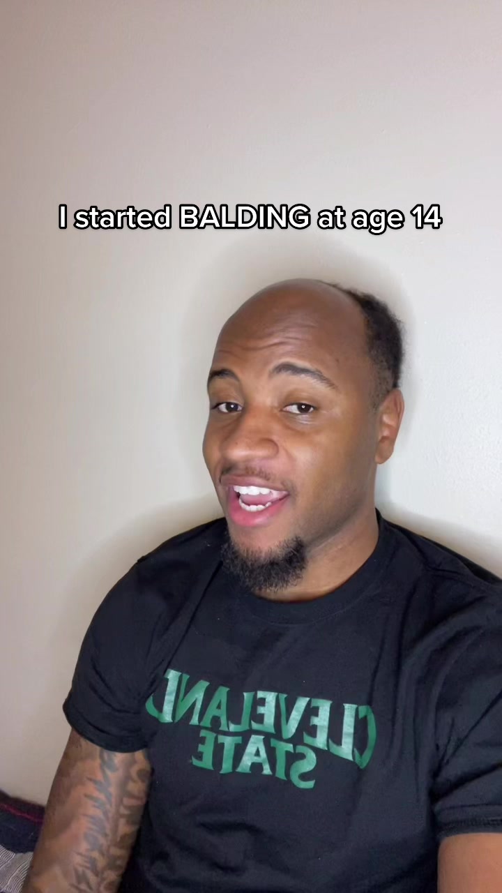 @Meechie “Bald Head”
