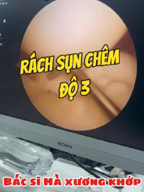 @Chuyên gia xương khớp