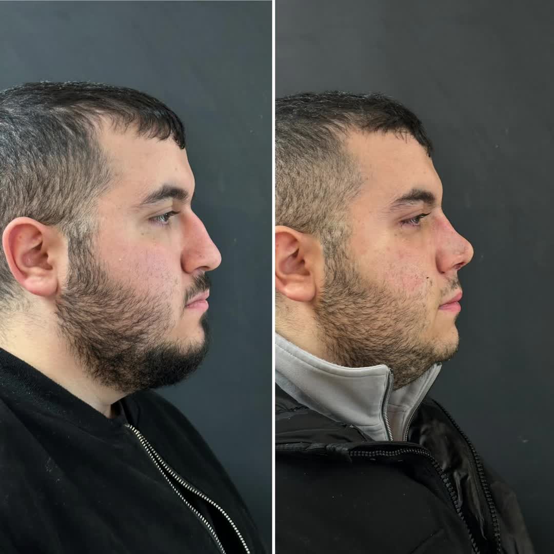@Dr. NurtenKucuk