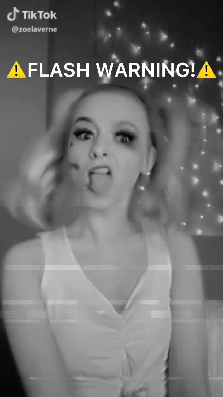 @ZOE NOTICED 💞