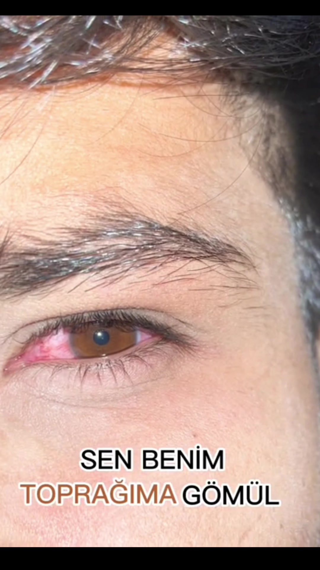 @Furkan OGR