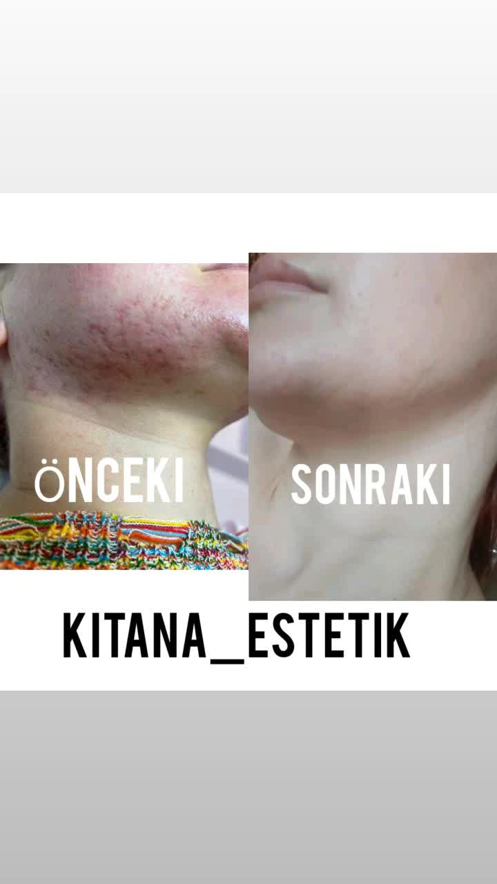 @kitanaestetik