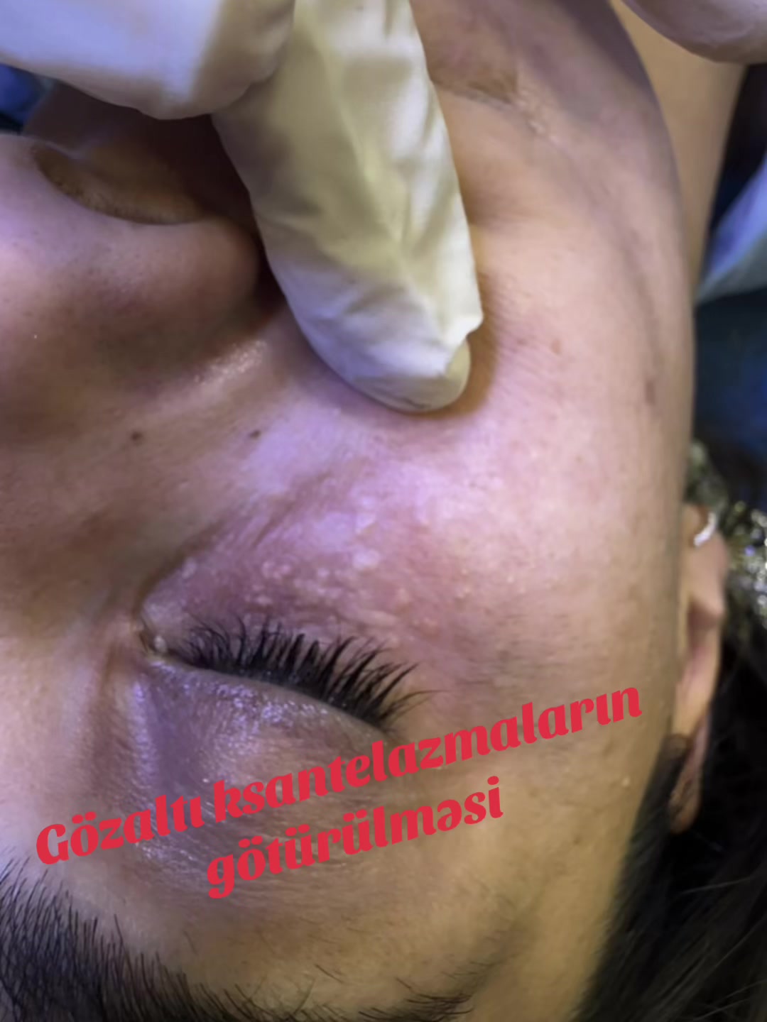 @G&ouml;y&ccedil;aykosmetoloqnazı