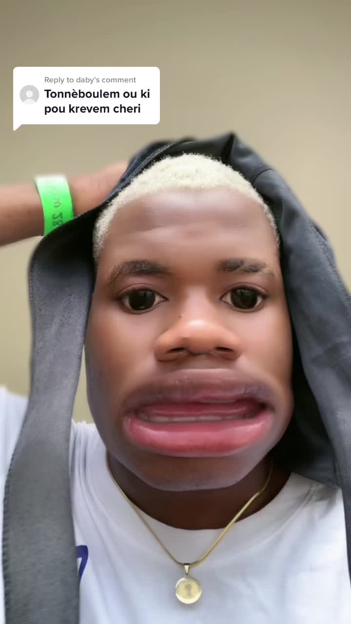 @𝕋𝕣𝕒𝕡 𝕤𝕥𝕒𝕣🇭🇹💔🐐