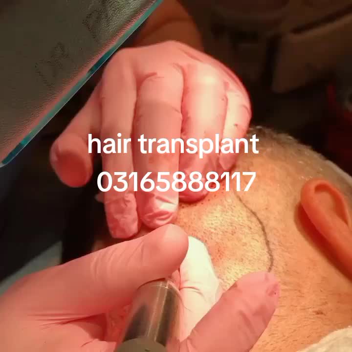 @6D hair Extensions