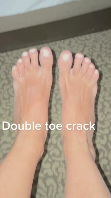 @Snap, Crackle and Pop