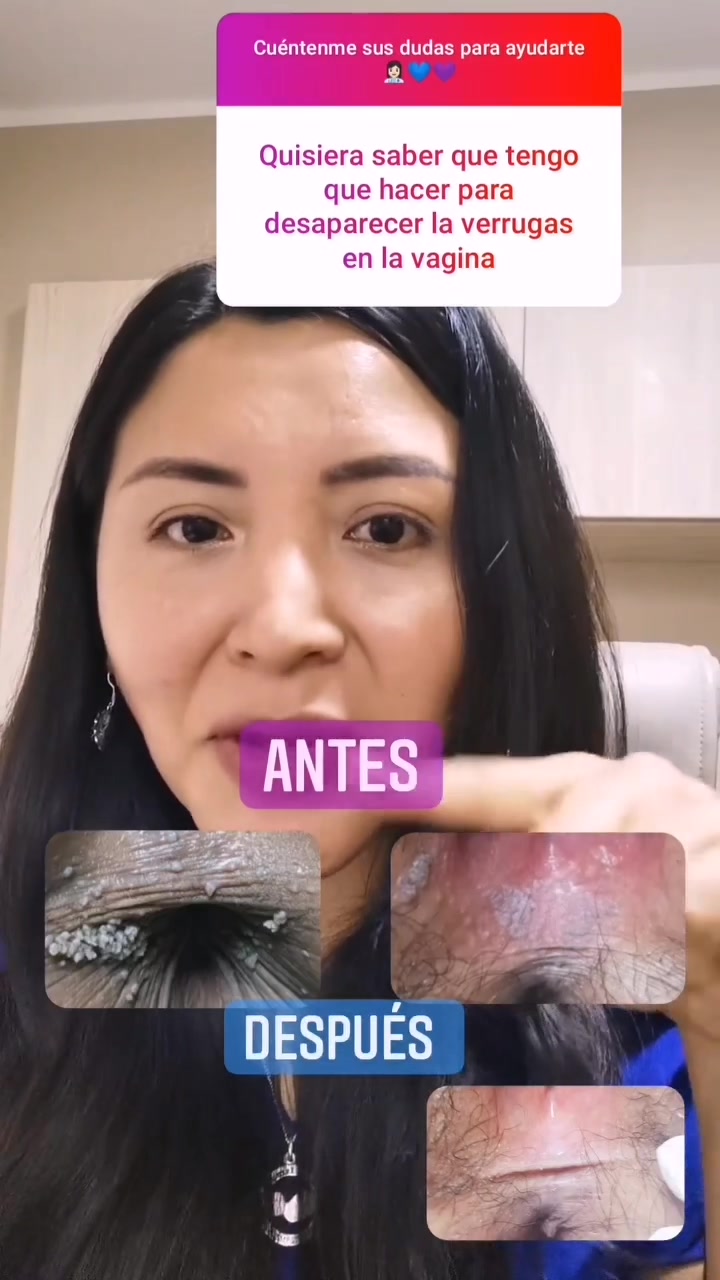 @Ginec&oacute;loga 🇵🇪 Dra Karina