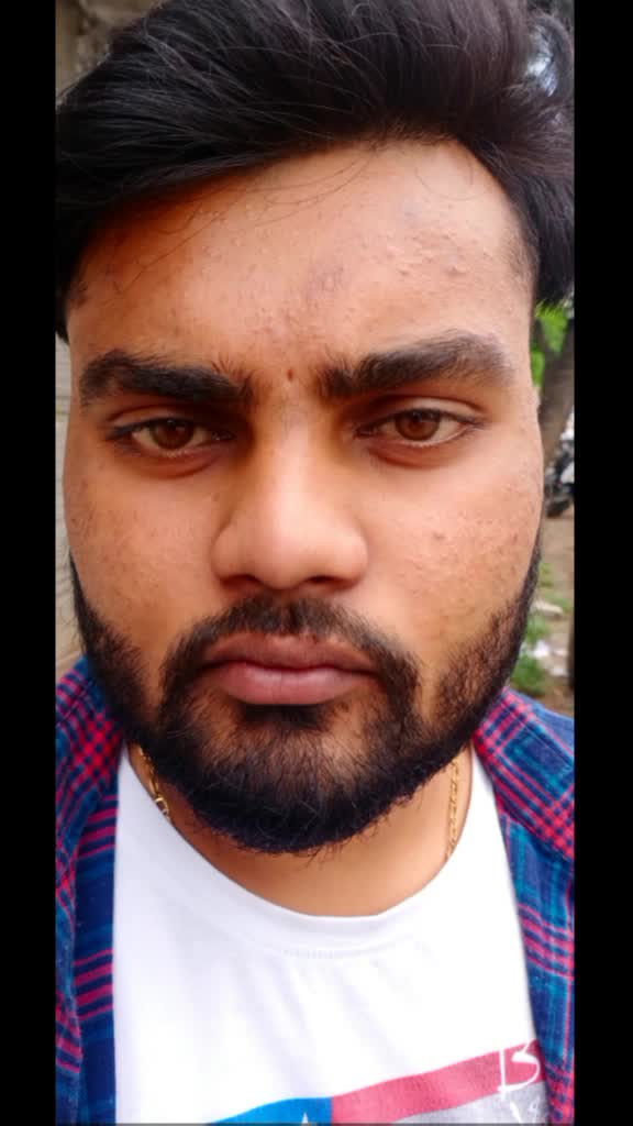 @Vishal Gupta