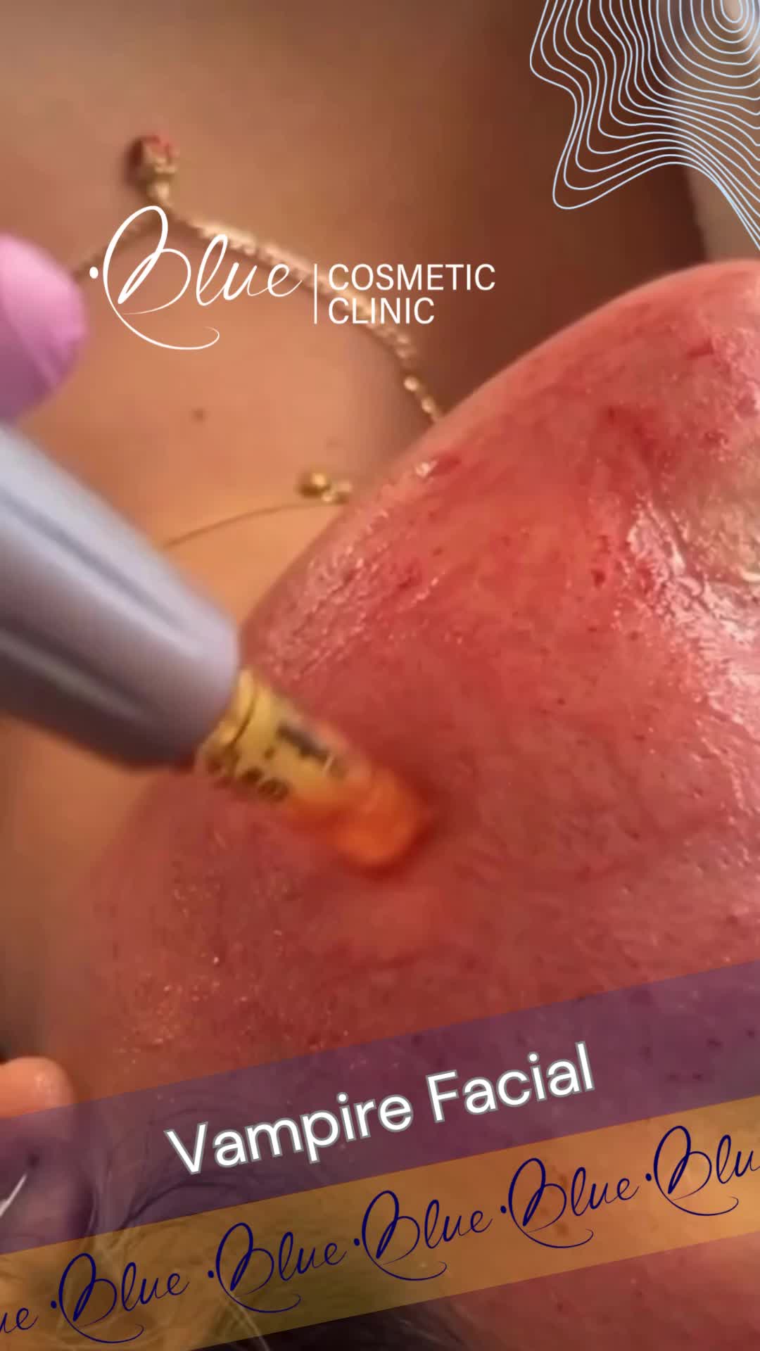 @BlueMedi.ca