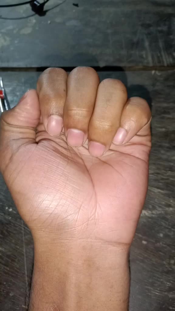 @JINASH GOGOI ๐