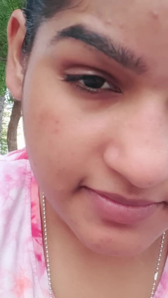 @angal