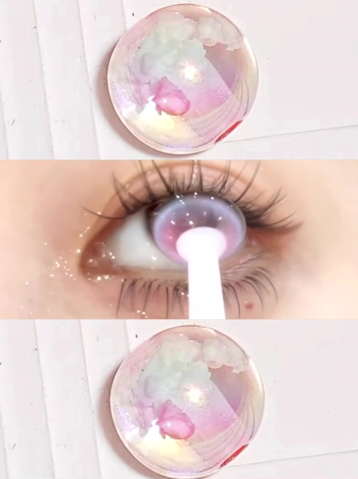 @4YOU Contact Lens