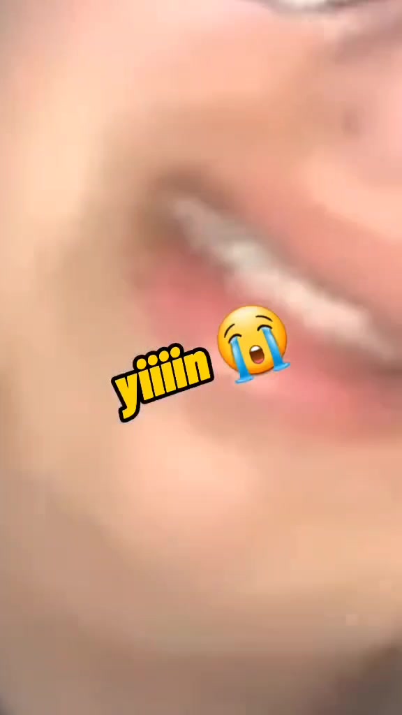@아미