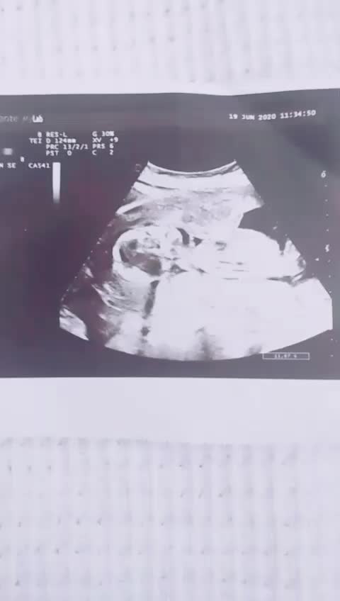 @Fatma♡yasinim