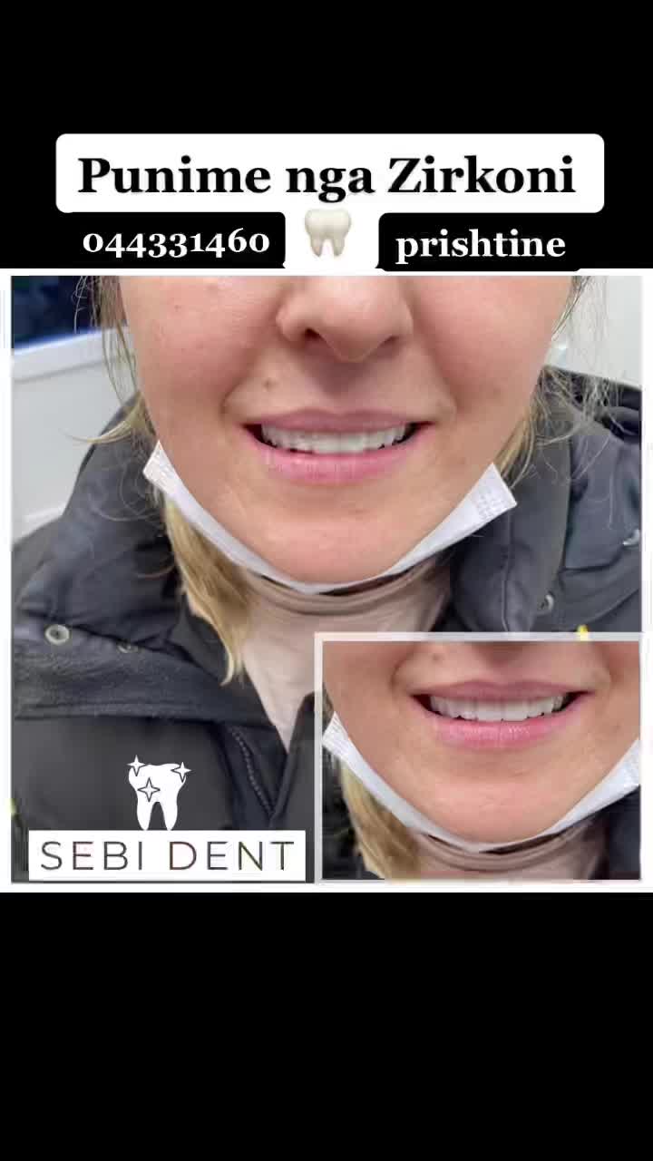 @sebi dent