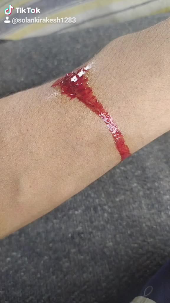 @Solankirakesh1283
