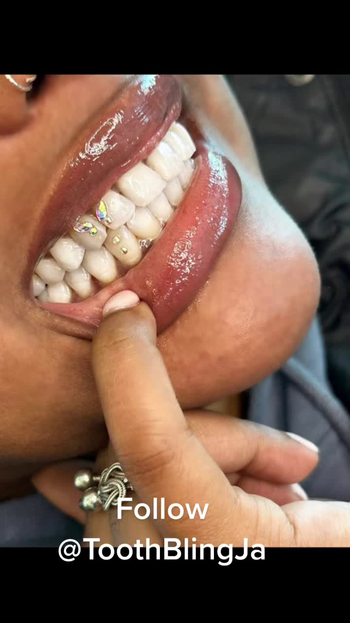 @ToothBlingJa