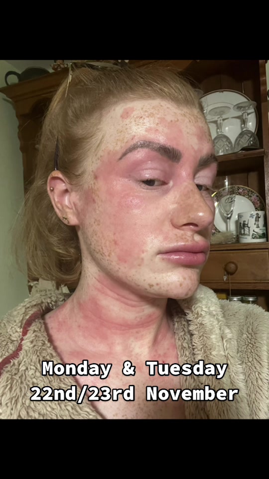 @my journey to repair my skin