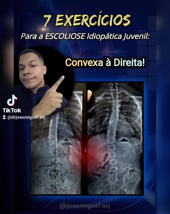 @Jo&atilde;o Miguel ASJ