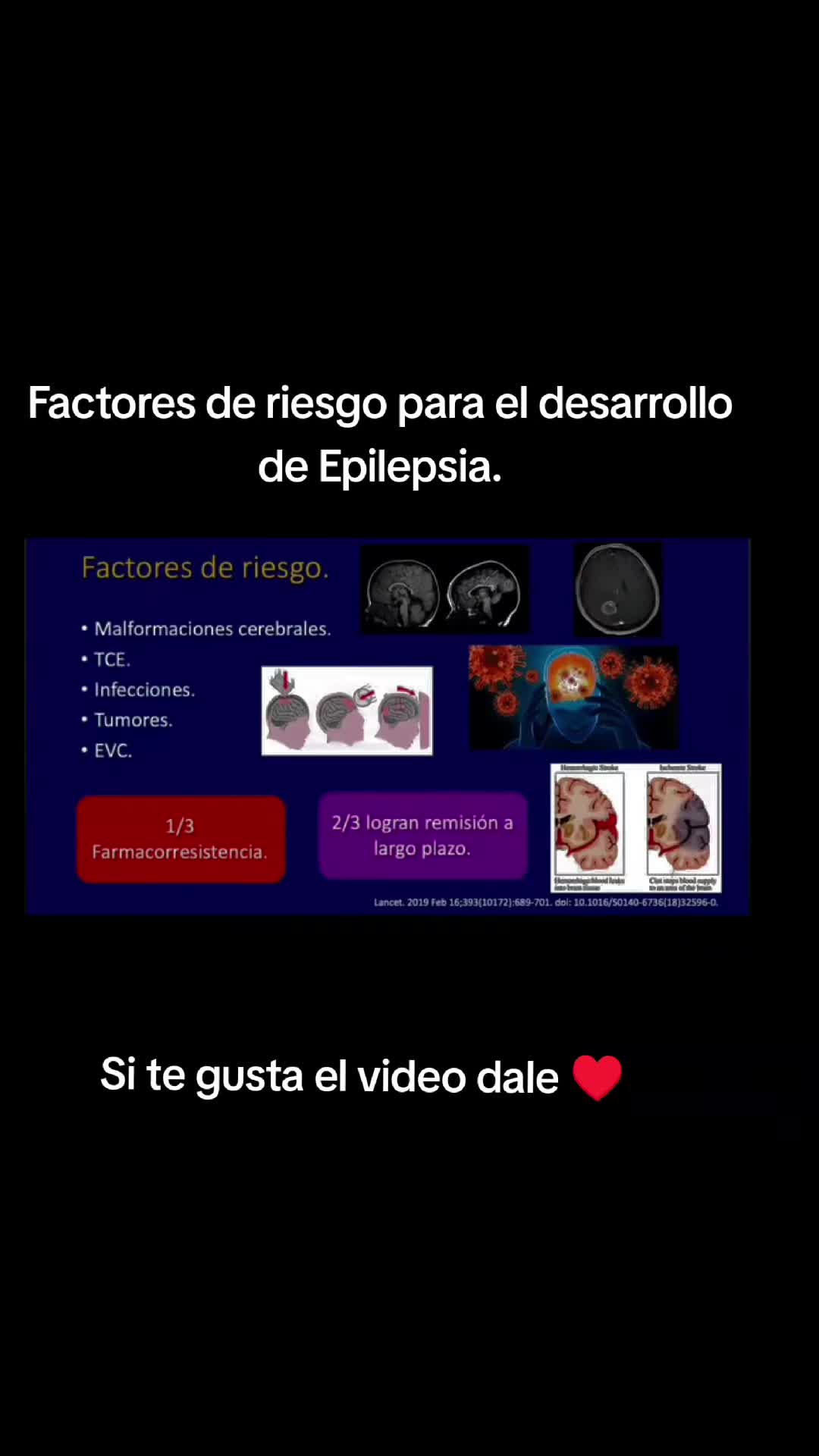 @Dr. Ajolote.
