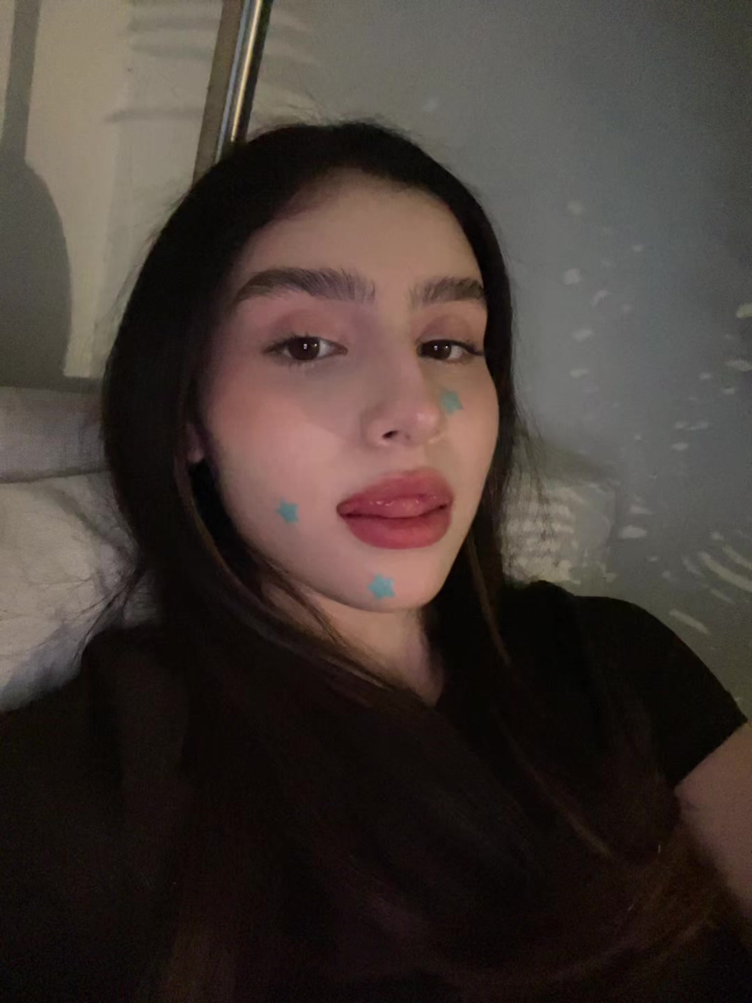 @4524_ess