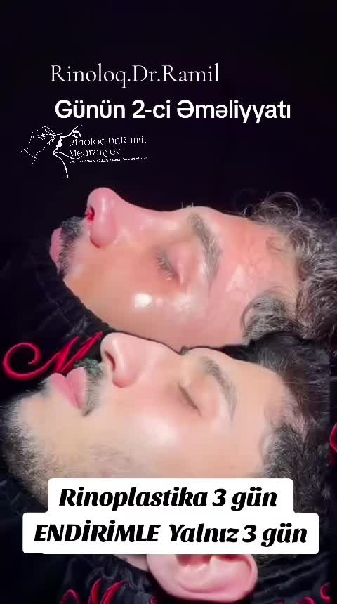 @Rinoloq 055 555 41 46