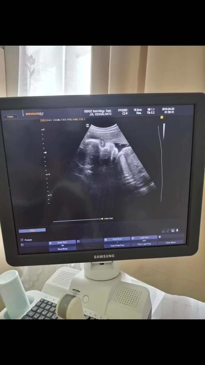 @Elizám❤️🧑🍼💎